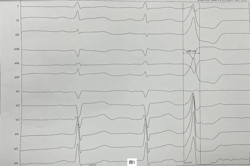 17275716025196.jpg