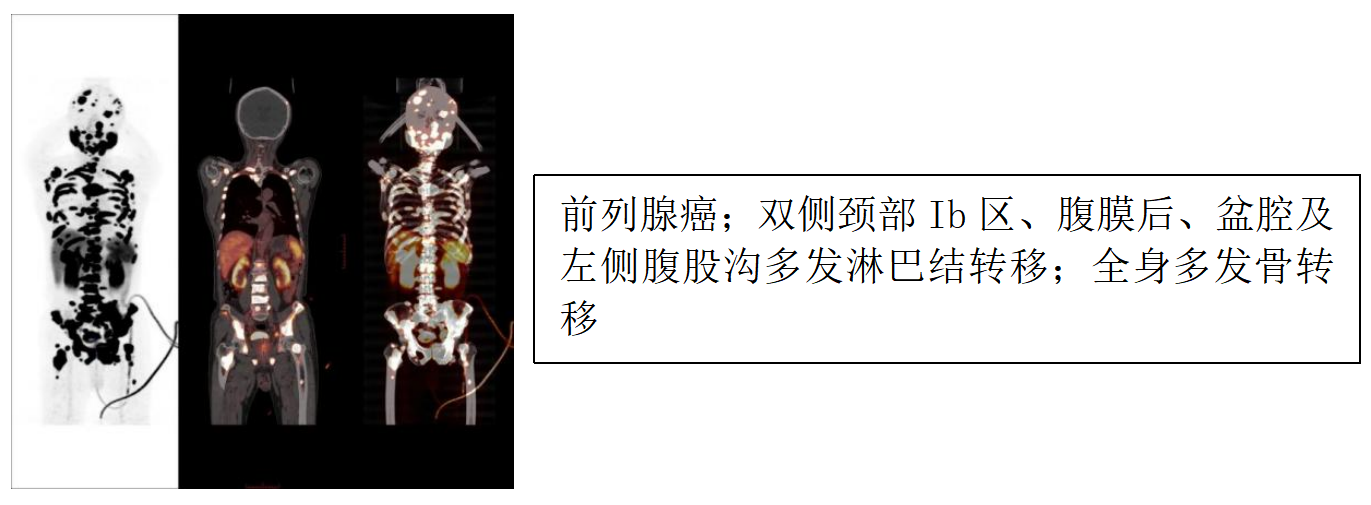 17407037837356.png