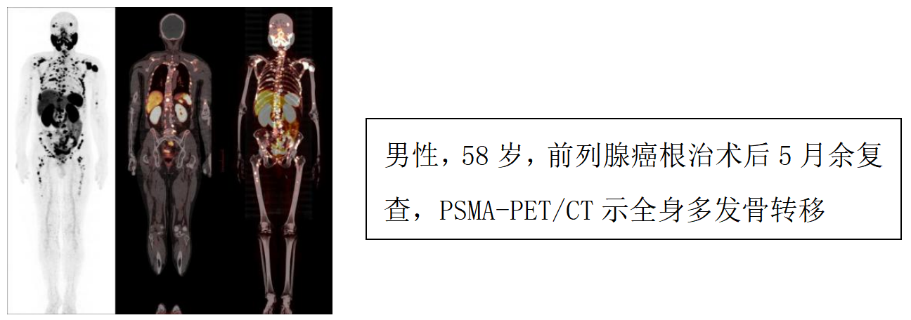 17407037992025.png