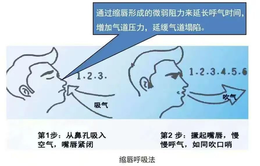17439963132105.png